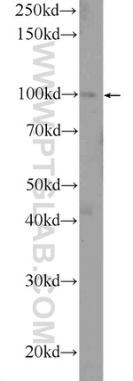 USHBP1 Antibody in Western Blot (WB)