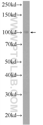 USHBP1 Antibody in Western Blot (WB)
