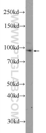 USHBP1 Antibody in Western Blot (WB)