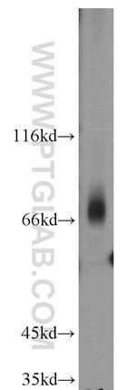 CD5 Antibody in Western Blot (WB)