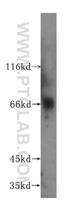 CD5 Antibody in Western Blot (WB)