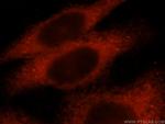 KLHL18 Antibody in Immunocytochemistry (ICC/IF)