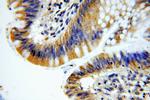 KLHL18 Antibody in Immunohistochemistry (Paraffin) (IHC (P))