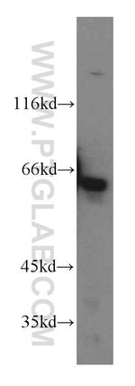 KLHL18 Antibody in Western Blot (WB)