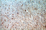KLHL18 Antibody in Immunohistochemistry (Paraffin) (IHC (P))