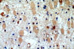 KLHL18 Antibody in Immunohistochemistry (Paraffin) (IHC (P))