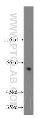 KLHL18 Antibody in Western Blot (WB)