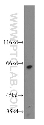 KLHL18 Antibody in Western Blot (WB)