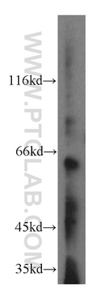 KLHL18 Antibody in Western Blot (WB)