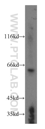 KLHL18 Antibody in Western Blot (WB)