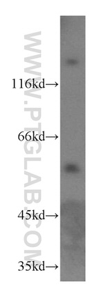 KLHL18 Antibody in Western Blot (WB)