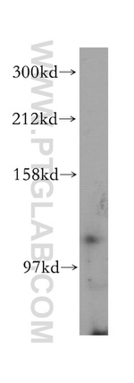 TLR7 Antibody in Western Blot (WB)