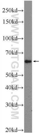 CORO6 Antibody in Western Blot (WB)