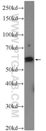 CORO6 Antibody in Western Blot (WB)