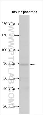 SEC16B Antibody in Western Blot (WB)
