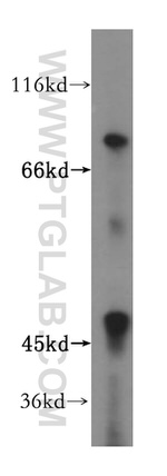 ZNF611 Antibody in Western Blot (WB)