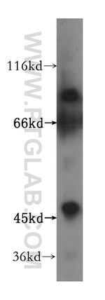 ZNF611 Antibody in Western Blot (WB)