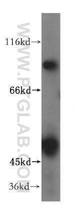 ZNF611 Antibody in Western Blot (WB)