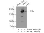 RB1CC1 Antibody in Immunoprecipitation (IP)