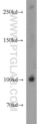 BBX Antibody in Western Blot (WB)