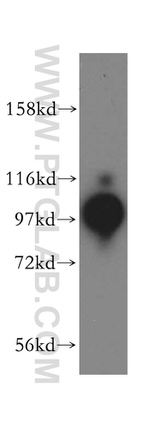 BBX Antibody in Western Blot (WB)