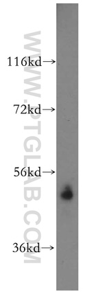 SARS2 Antibody in Western Blot (WB)