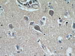 MRAP2 Antibody in Immunohistochemistry (Paraffin) (IHC (P))