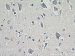 MRAP2 Antibody in Immunohistochemistry (Paraffin) (IHC (P))
