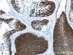 Cytokeratin 16 Antibody in Immunohistochemistry (Paraffin) (IHC (P))