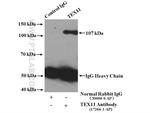 TEX11 Antibody in Immunoprecipitation (IP)