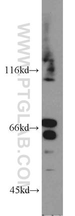 TEX11 Antibody in Western Blot (WB)