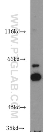 TEX11 Antibody in Western Blot (WB)