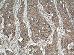 RUNDC1 Antibody in Immunohistochemistry (Paraffin) (IHC (P))