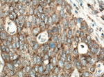 RUNDC1 Antibody in Immunohistochemistry (Paraffin) (IHC (P))