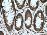 RUNDC1 Antibody in Immunohistochemistry (Paraffin) (IHC (P))