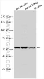 UGT3A1 Antibody in Western Blot (WB)