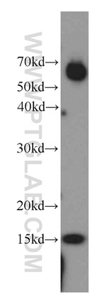 POLR2I Antibody in Western Blot (WB)