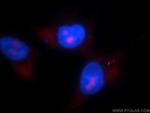 CALML3 Antibody in Immunocytochemistry (ICC/IF)