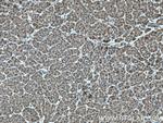CALML3 Antibody in Immunohistochemistry (Paraffin) (IHC (P))