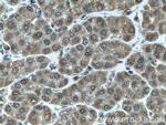 CALML3 Antibody in Immunohistochemistry (Paraffin) (IHC (P))