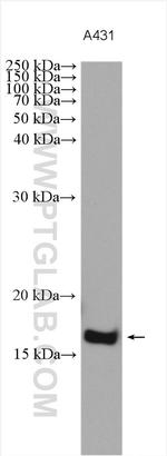 CALML3 Antibody in Western Blot (WB)