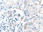 MT1M Antibody in Immunohistochemistry (Paraffin) (IHC (P))