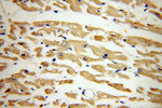 MYL7 Antibody in Immunohistochemistry (Paraffin) (IHC (P))