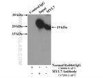 MYL7 Antibody in Immunoprecipitation (IP)