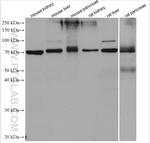 SLC39A5 Antibody in Western Blot (WB)