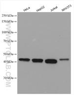 TRMT10A Antibody in Western Blot (WB)