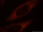 RPS4Y1 Antibody in Immunocytochemistry (ICC/IF)