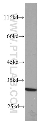 RPS4Y1 Antibody in Western Blot (WB)