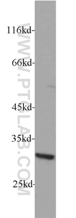 RPS4Y1 Antibody in Western Blot (WB)