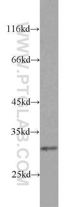 RPS4Y1 Antibody in Western Blot (WB)